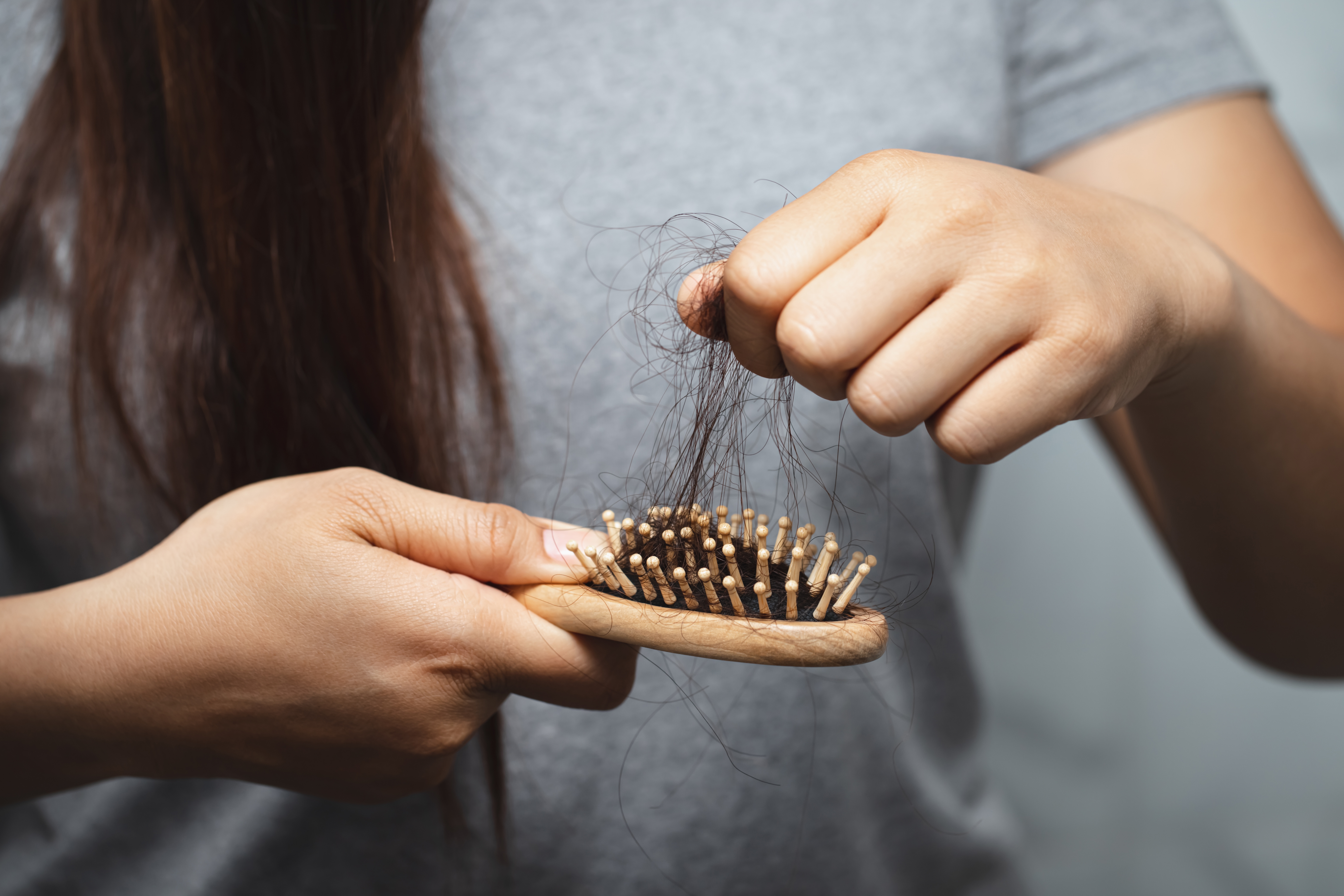 La caída del cabello: Tipos, causas y tratamiento